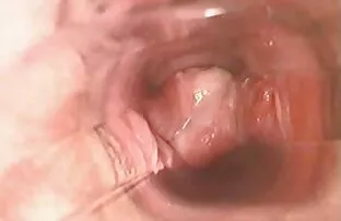 XXX 古董,开拓者胖乎乎的女孩糖果 最好的同性恋色情片